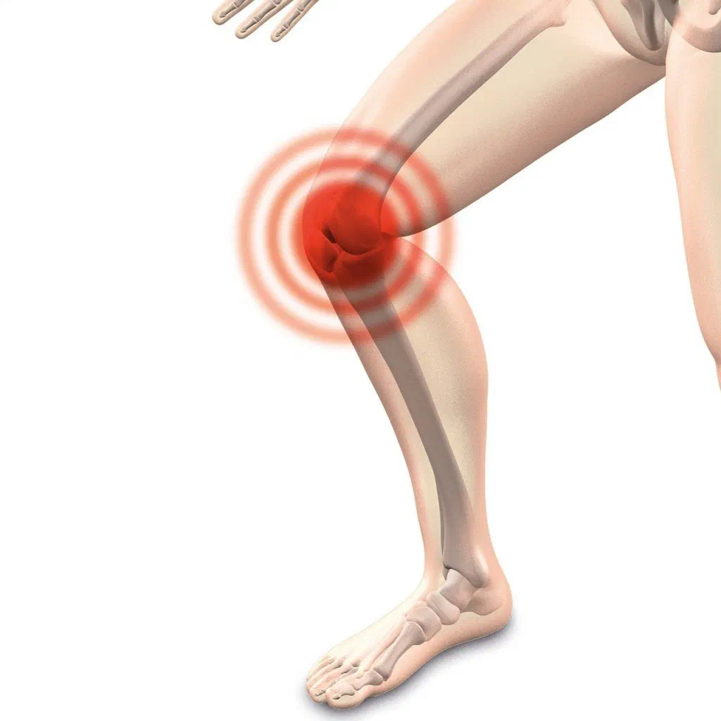 knee inflammation